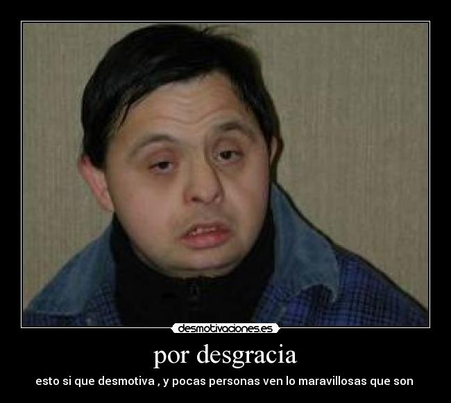 por desgracia - esto si que desmotiva , y pocas personas ven lo maravillosas que son 