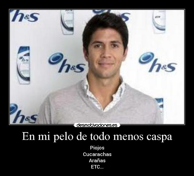 En mi pelo de todo menos caspa -