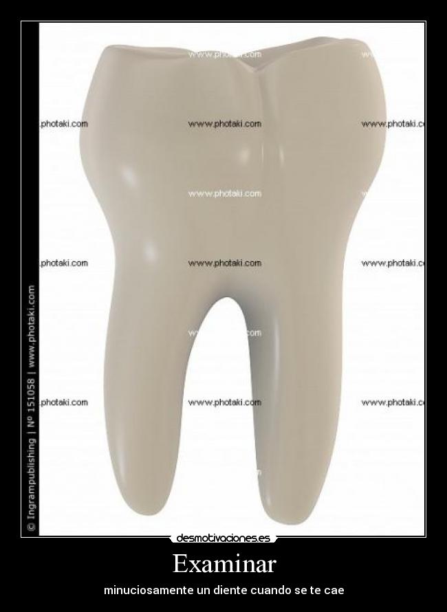 Examinar - minuciosamente un diente cuando se te cae