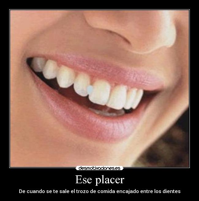 Ese placer - De cuando se te sale el trozo de comida encajado entre los dientes