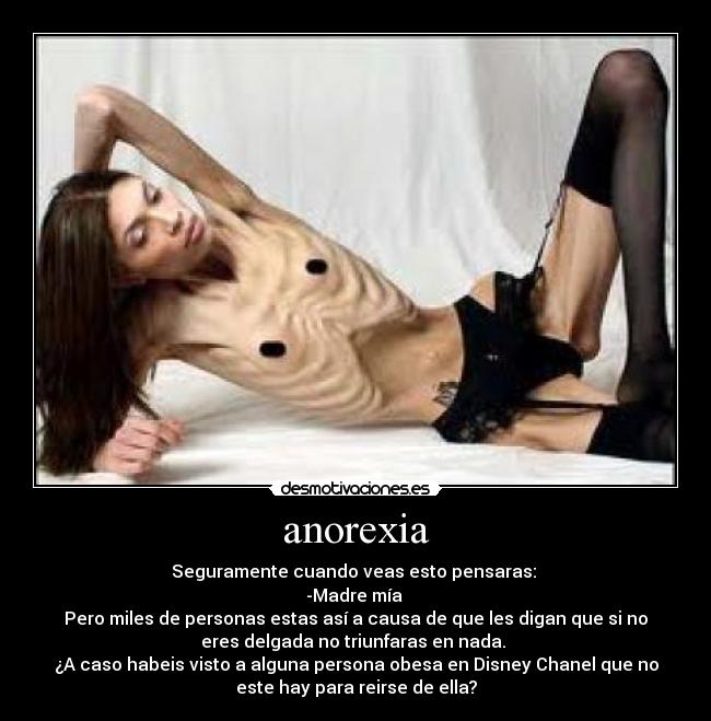 carteles anorexia desmotivaciones