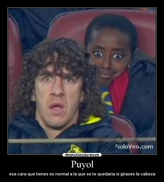 Puyol - esa cara que tienes es normal a la que se te quedaria si girases la cabeza