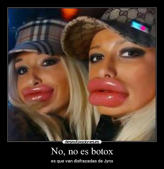 No, no es botox - es que van disfrazadas de Jynx