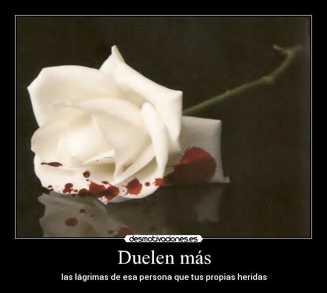 Duelen más -