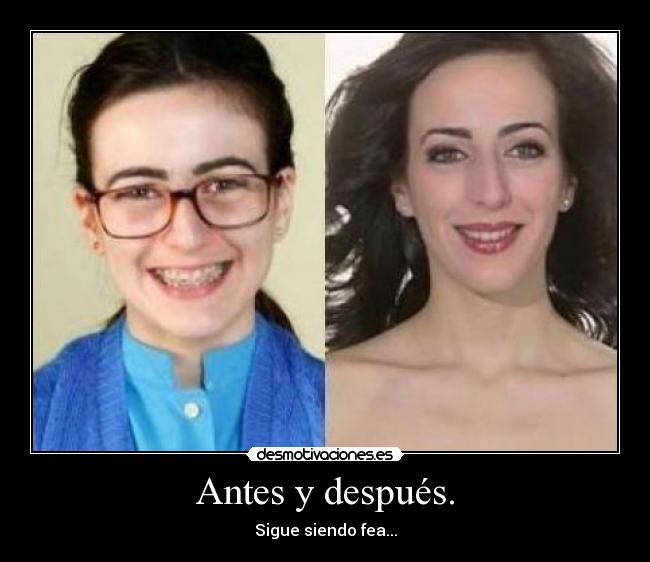 Antes y después. - Sigue siendo fea...