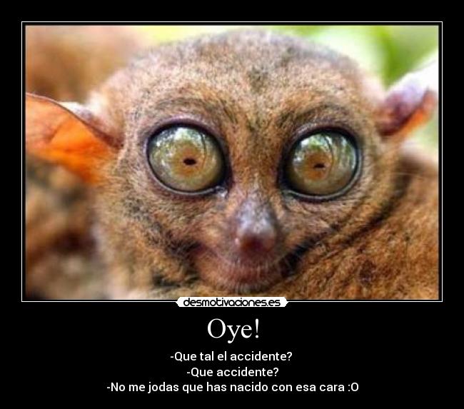 Oye! - -Que tal el accidente?
-Que accidente?
-No me jodas que has nacido con esa cara :O