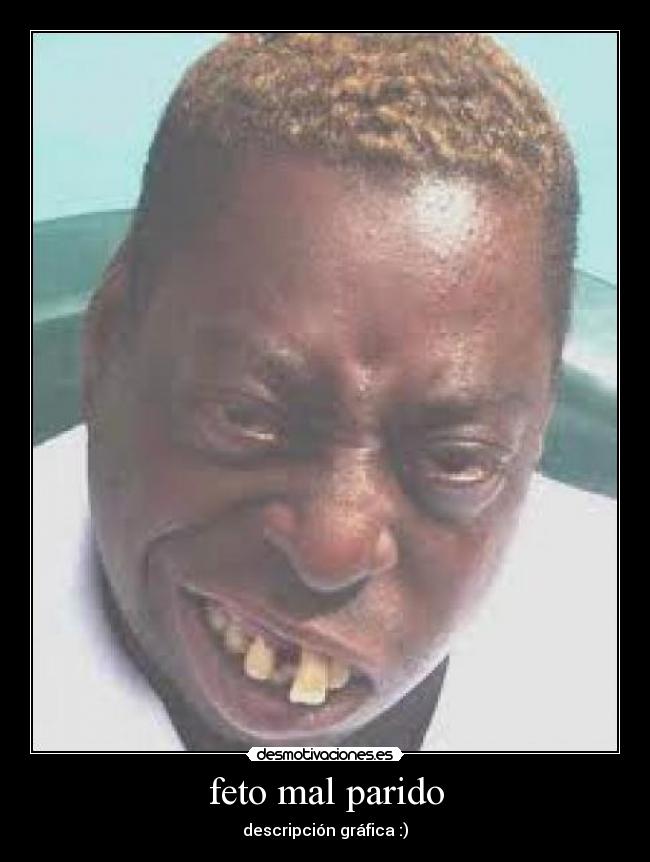 feto mal parido -