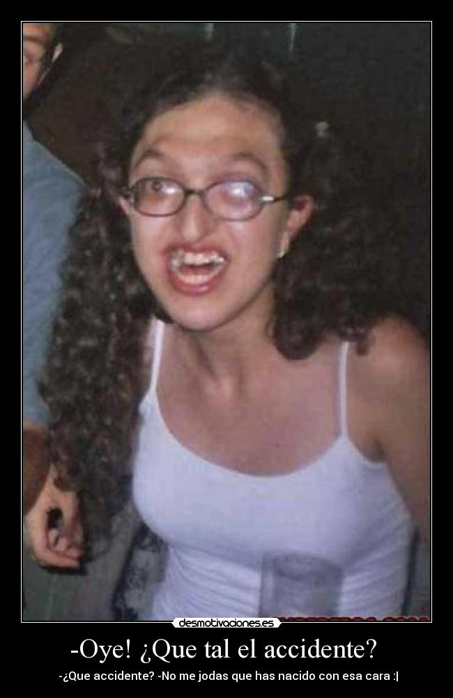 -Oye! ¿Que tal el accidente? -