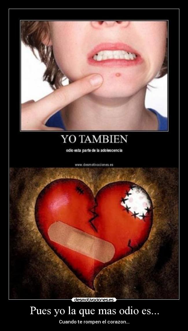 Pues yo la que mas odio es... - 