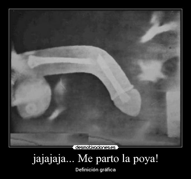 jajajaja... Me parto la poya! - 