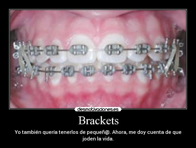 Brackets - 