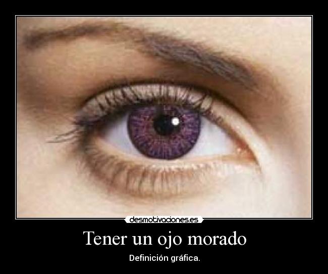 UN OJO MORADO un ojo morado: