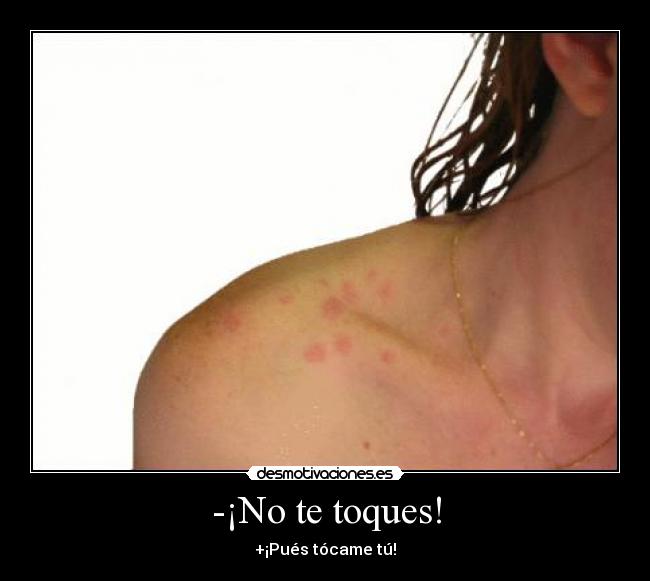 -¡No te toques! -