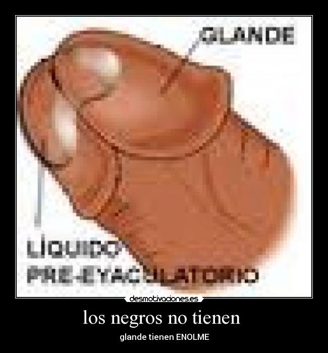 carteles ghsdf desmotivaciones