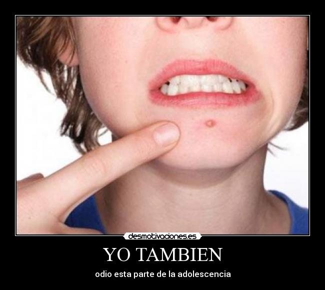 YO TAMBIEN - odio esta parte de la adolescencia