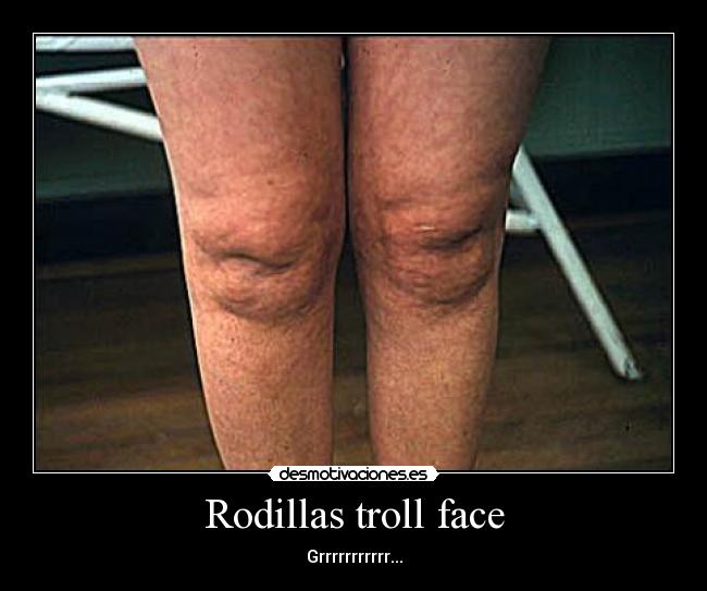 Rodillas troll face -