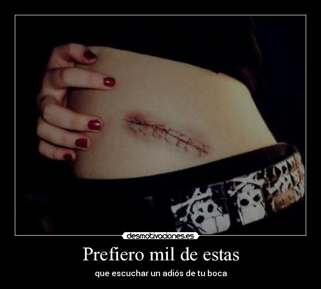 Prefiero mil de estas -