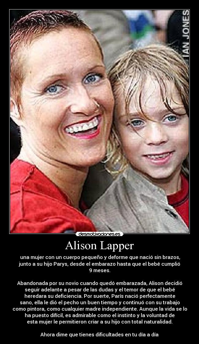 Alison Lapper -