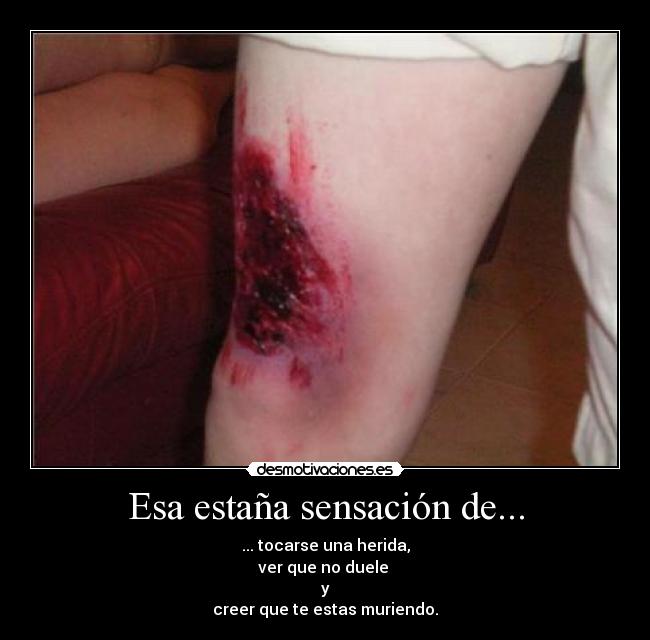 Esa estaña sensación de... - ... tocarse una herida,
ver que no duele
y
creer que te estas muriendo.