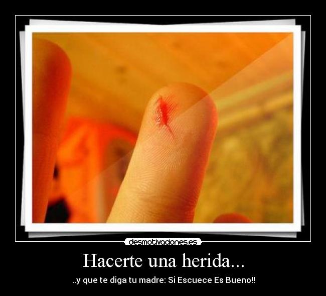 Hacerte una herida... - ..y que te diga tu madre: Si Escuece Es Bueno!!