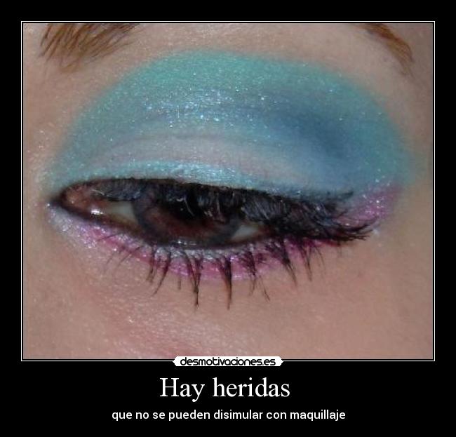 Hay heridas  - 