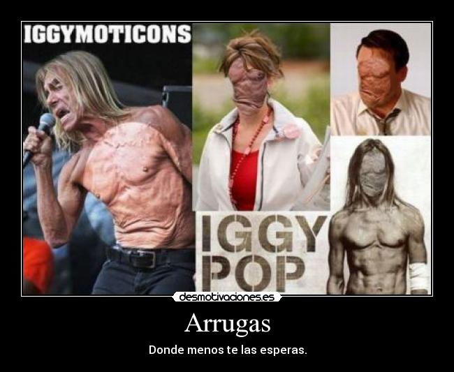 Arrugas - Donde menos te las esperas.