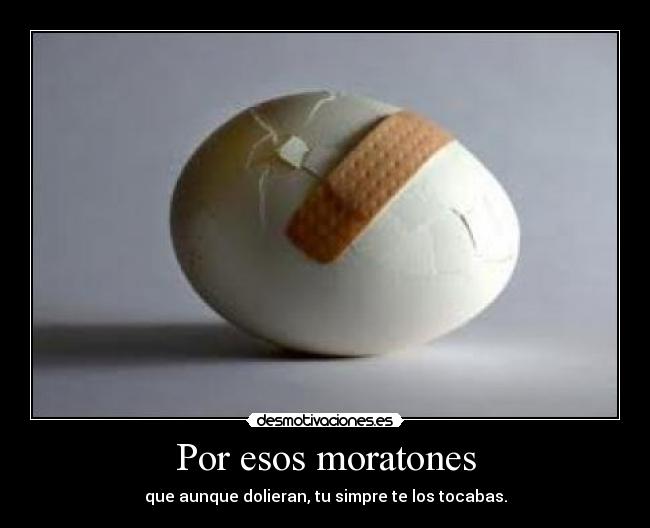 Por esos moratones - que aunque dolieran, tu simpre te los tocabas.