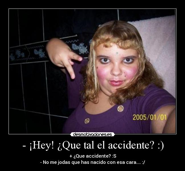 - ¡Hey! ¿Que tal el accidente? :) - + ¿Que accidente? :S
- No me jodas que has nacido con esa cara.... :/