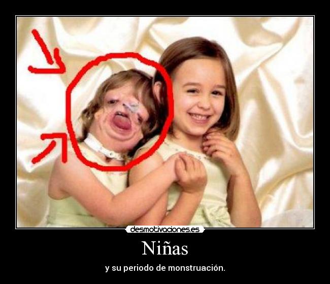 Niñas - 