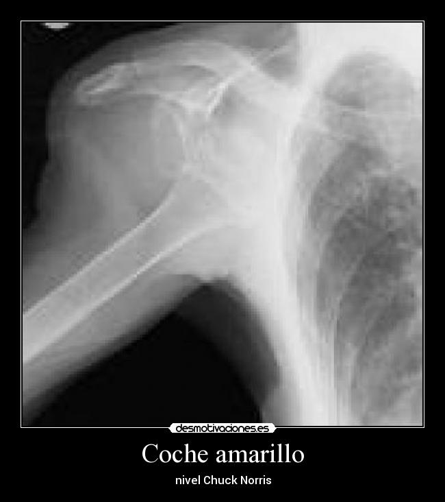 Coche amarillo - nivel Chuck Norris