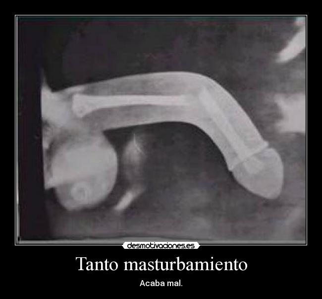 Tanto masturbamiento - 