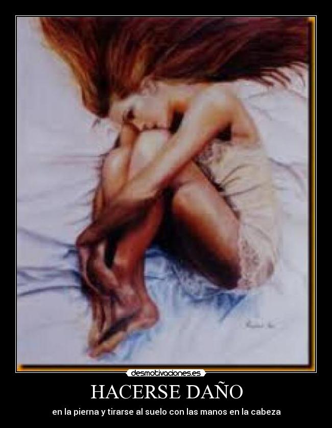 HACERSE DAÑO - en la pierna y tirarse al suelo con las manos en la cabeza