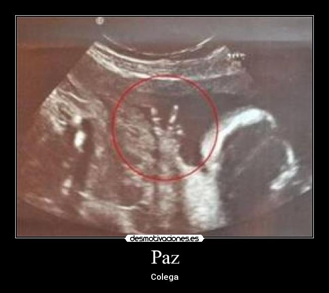 Paz -