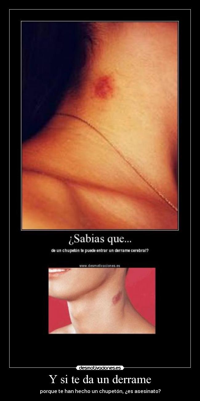 Y si te da un derrame - 