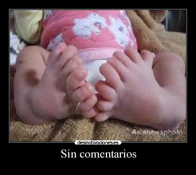 Sin comentarios -
