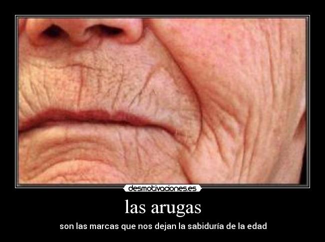 las arugas - son las marcas que nos dejan la sabiduría de la edad