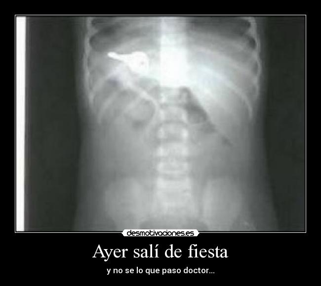 Ayer salí de fiesta - y no se lo que paso doctor...