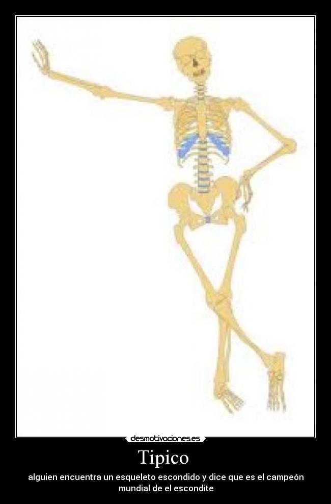 Tipico - alguien encuentra un esqueleto escondido y dice que es el campeón
mundial de el escondite