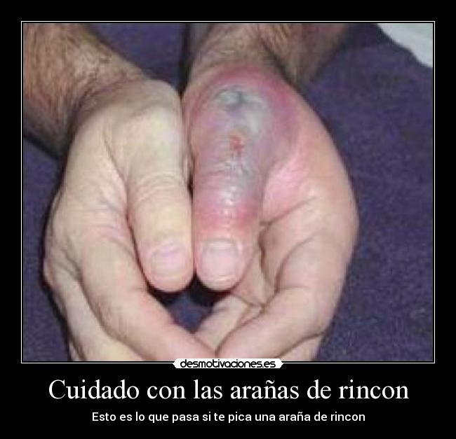 Cuidado con las arañas de rincon - 