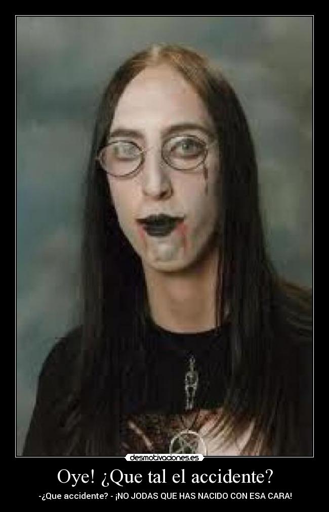 Oye! ¿Que tal el accidente? - -¿Que accidente? - ¡NO JODAS QUE HAS NACIDO CON ESA CARA!