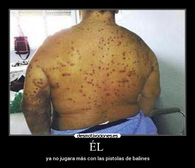 ÉL - ya no jugara más con las pistolas de balines