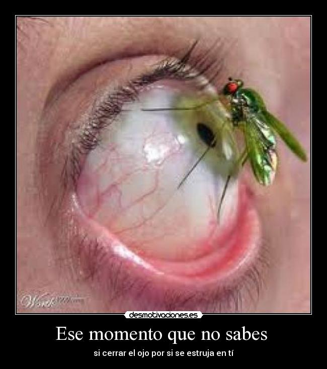 Ese momento que no sabes  - si cerrar el ojo por si se estruja en tí