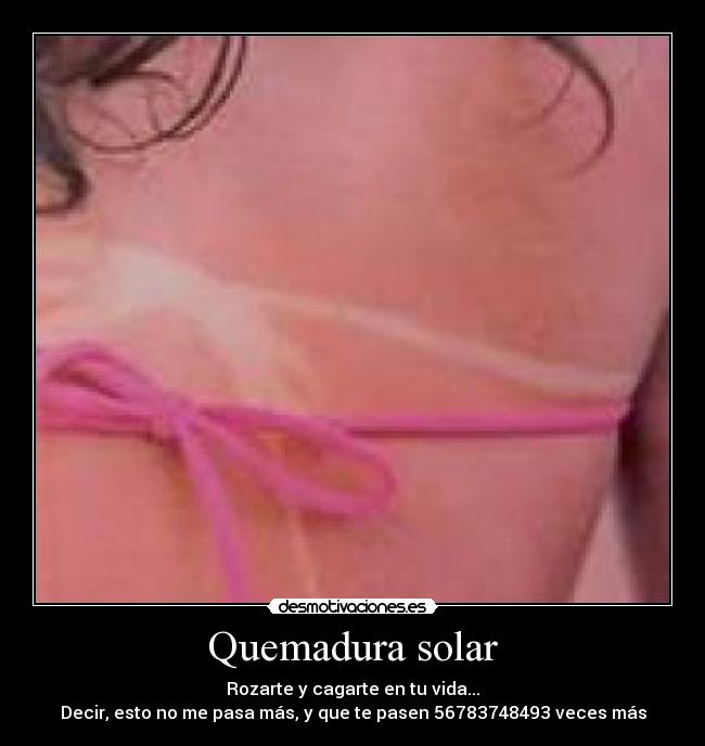 Quemadura solar - Rozarte y cagarte en tu vida...
Decir, esto no me pasa más, y que te pasen 56783748493 veces más