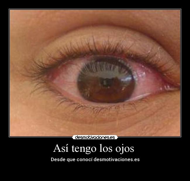 Así tengo los ojos - Desde que conocí desmotivaciones.es