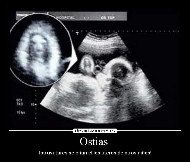 Ostias  - 