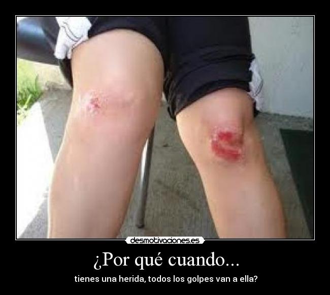 ¿Por qué cuando... - 