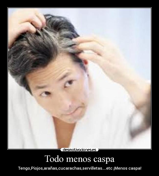 Todo menos caspa - 