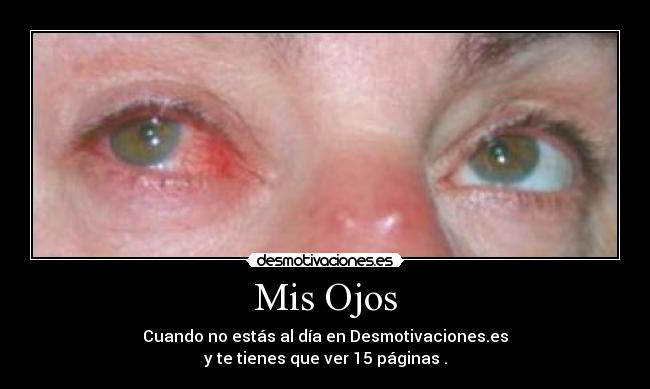 Mis Ojos - Cuando no estás al día en Desmotivaciones.es
y te tienes que ver 15 páginas .