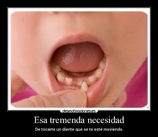 Esa tremenda necesidad - De tocarte un diente que se te esté moviendo.