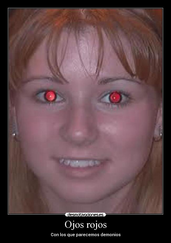 Ojos rojos - Con los que parecemos demonios